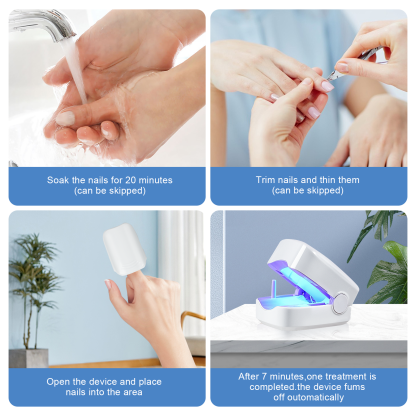Nail Fungus Laser Treatment LED Light Device(Model:HK702) - Image 6