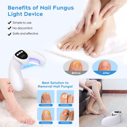 Nail Fungus Laser Treatment LED Light Device(Model:HK707) - Image 2