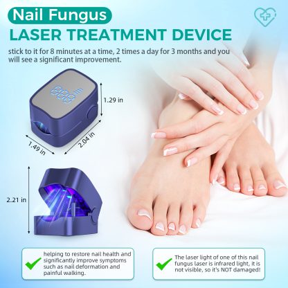 Nail Fungus Laser Treatment LED Light Device(Model:HK703) - Image 3