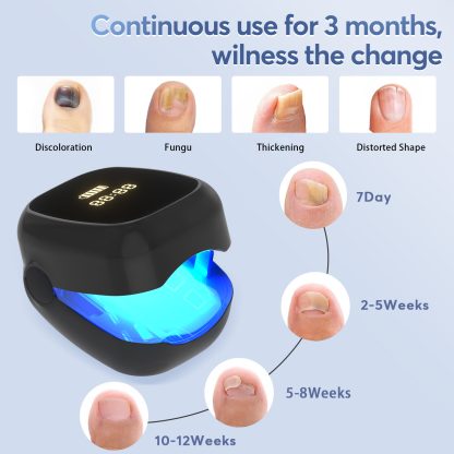 Nail Fungus Laser Treatment LED Light Device(Model:HK704) - Image 3