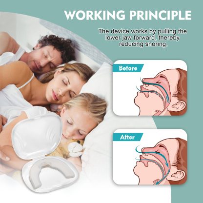 Aniti-Snore Mouthguard+ - Image 3