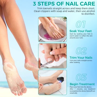 Nail Fungus Laser Treatment LED Light Device(Model:HK702) - Image 3