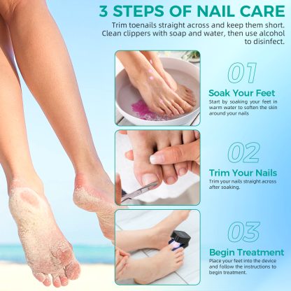 Nail Fungus Laser Treatment LED Light Device(Model:HK703) - Image 4
