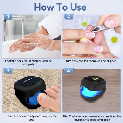 Nail Fungus Laser Treatment LED Light Device(Model:HK704) - Image 4
