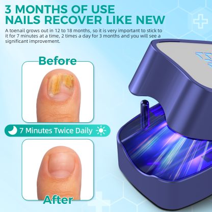 Nail Fungus Laser Treatment LED Light Device(Model:HK703) - Image 5