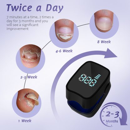 Nail Fungus Laser Treatment LED Light Device(Model:HK703) - Image 6