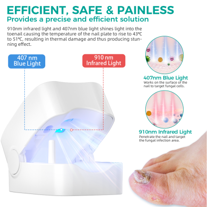 Nail Fungus Laser Treatment LED Light Device(Model:HK703) - Image 2