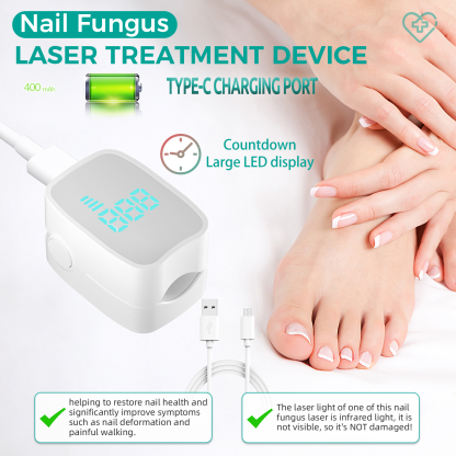 Nail Fungus Laser Treatment LED Light Device(Model:HK703) - Image 3