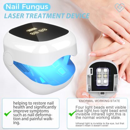 Nail Fungus Laser Treatment LED Light Device(Model:HK704) - Image 4