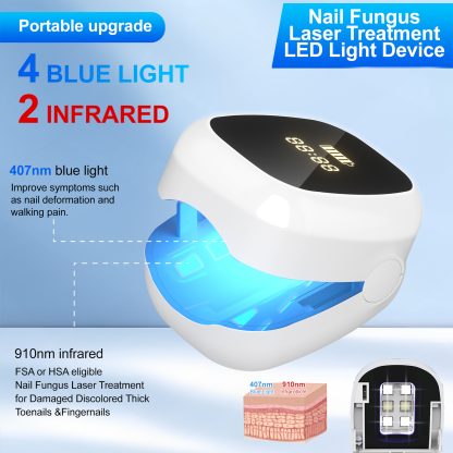 Nail Fungus Laser Treatment LED Light Device(Model:HK704) - Image 6