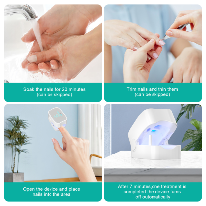 Nail Fungus Laser Treatment LED Light Device(Model:HK703) - Image 6